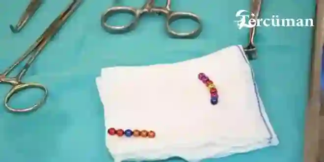 4 yaşındaki çocuğun bağırsağından 13 mıknatıslı boncuk çıktı