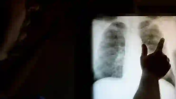 En büyük üçüncü ölüm nedeni: 652 milyon kişi mücadele veriyor