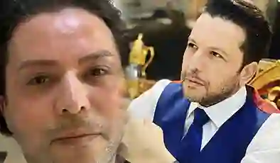 Nihat Doğan estetik yaptırdı!