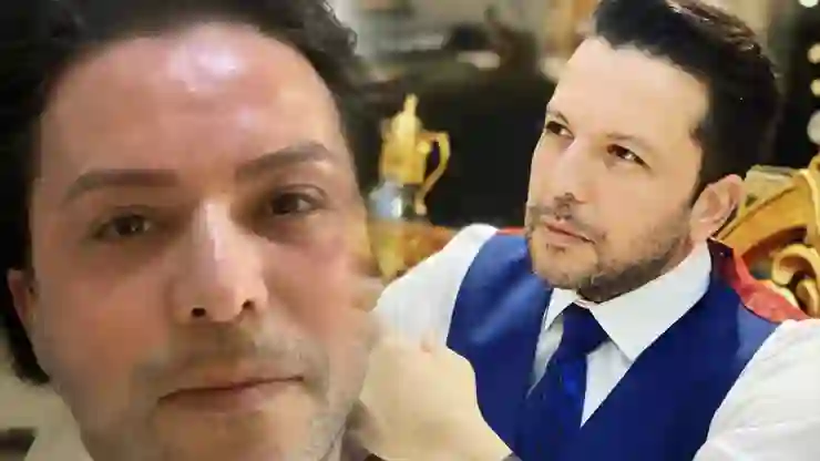 Nihat Doğan estetik yaptırdı!