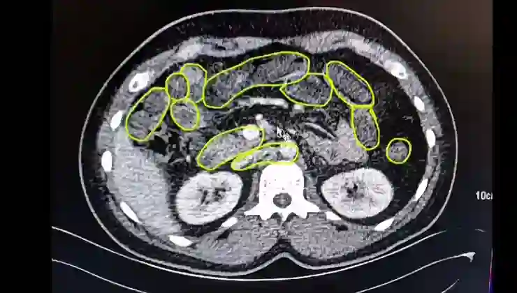 Midesinde uyuşturucu saklayan üç kişi yakalandı