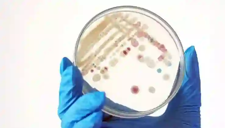 ABD’de “et yiyen bakteri” alarmı: 2025’te 9 kişi öldü