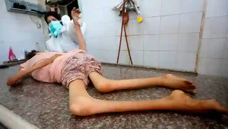 Bir çocuk daha İsrail’in açlık savaşının kurbanı oldu