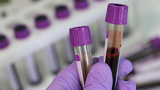 Kan kanserinde "immünoterapilerle" tedavide yeni dönem