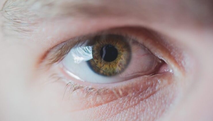 Tıpta çığır açan başarı: Dünyada ilk kez 3D basılmış kornea nakli gerçekleştirildi