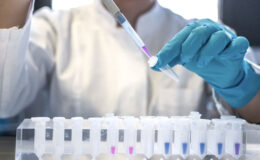 DSÖ: 2024'te 1,3 milyon kişinin AIDS hastalığına yakalandı