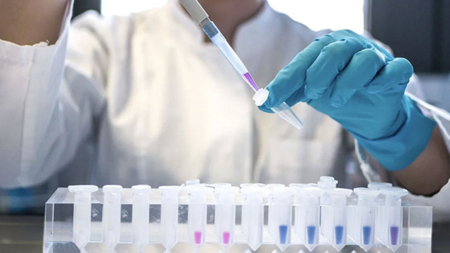 DSÖ: 2024'te 1,3 milyon kişinin AIDS hastalığına yakalandı