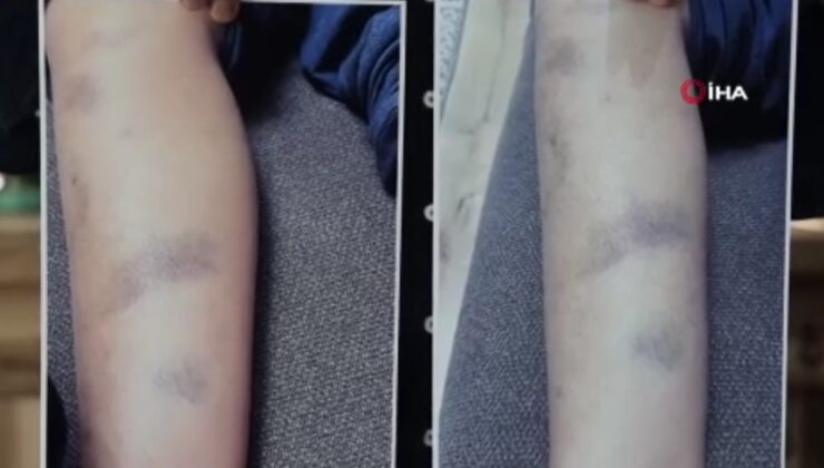 Diyarbakır’da özel okulda öğrenciye dayak iddiasına soruşturma