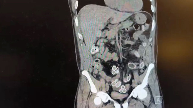 Tomografisini gören doktorlar polisi aradı, gözaltına alındı